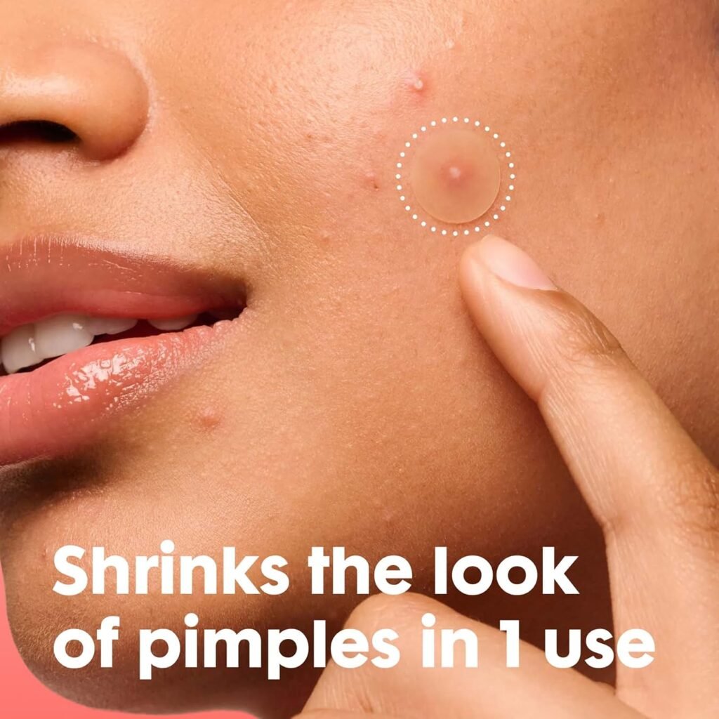 Mighty Patch Review 2026: Is It Worth Buying for Acne and Whiteheads?