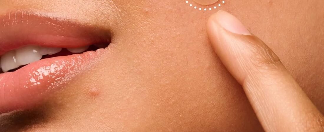 Mighty Patch Review 2026: Is It Worth Buying for Acne and Whiteheads?
